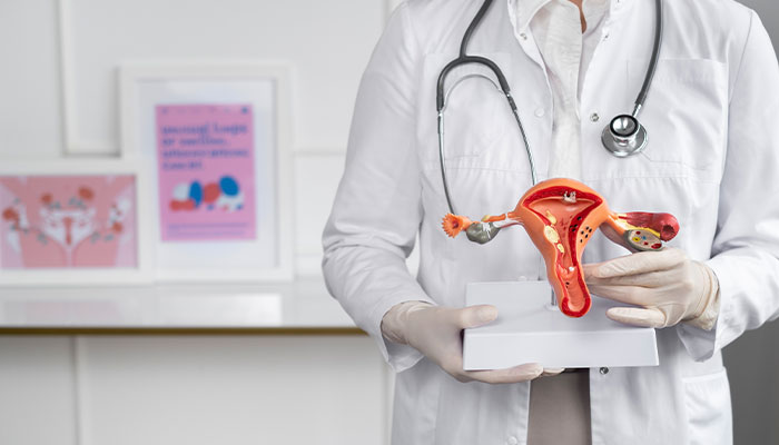 Polycystic Ovary Syndrome (PCOS)