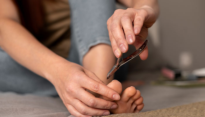 Trim Toenails Regularly